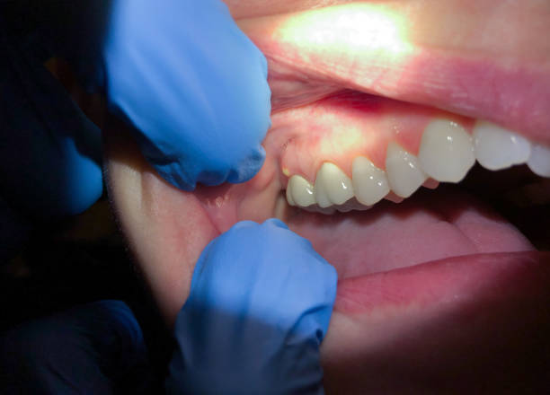 Best Emergency Dentist Near Me  in Girard, KS