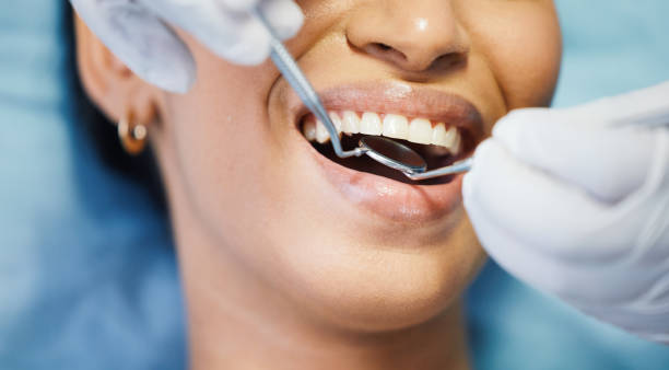 Best Emergency Dental Filling Replacement  in Girard, KS